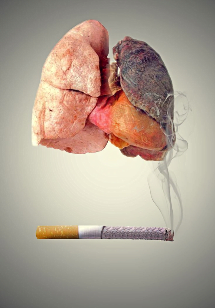 O cigarro pode causar doenças respiratórias.