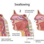 Dysphagia and its Impact on Nutrition and Health 32 AtlanticRide
